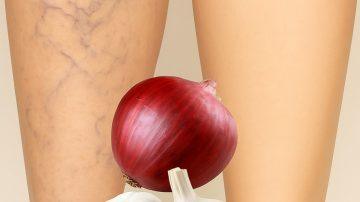 🌿 Shocking Truth: Flush Out Intestinal Parasites in Minutes with These Powerhouse Foods!