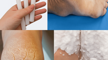 ✨ Dazzle with a Radiant Smile: The Lemon and Baking Soda Secret