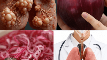 🌳 Unlock the Hidden Power of American Sweetgum: 7 Astonishing Health Benefits You Need to Know