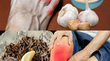 Discover Horse Chestnut: Nature’s Secret Weapon for Swollen Legs and Beyond 🌿