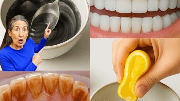 🌟 Unlock Rapunzel-Worthy Hair: The Ultimate onion and Rice Recipe for Crazy Long Locks