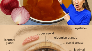 Banana Blossom: The Hidden Gem That Boosts Your Health and Plates 🍌🌸