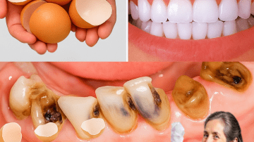 ✨ Dazzle with a Radiant Smile: The Lemon and Baking Soda Secret