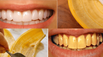 🌿 Can Salt Really Banish Bedbugs from Your Garden in Minutes? Uncover the Truth!