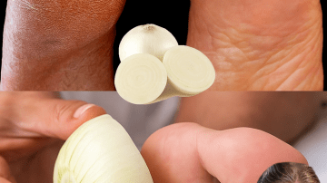 🌟 Unlock Rapunzel-Worthy Hair: The Ultimate onion and Rice Recipe for Crazy Long Locks