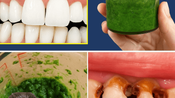 Banana Blossom: The Hidden Gem That Boosts Your Health and Plates 🍌🌸