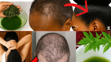 🌟 Avocado and Banana: The Morning Duo That Transforms Your Health