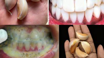 Unlock the Secrets of Taro: The Ancient Root That’s Hiding Superpowers on Your Plate